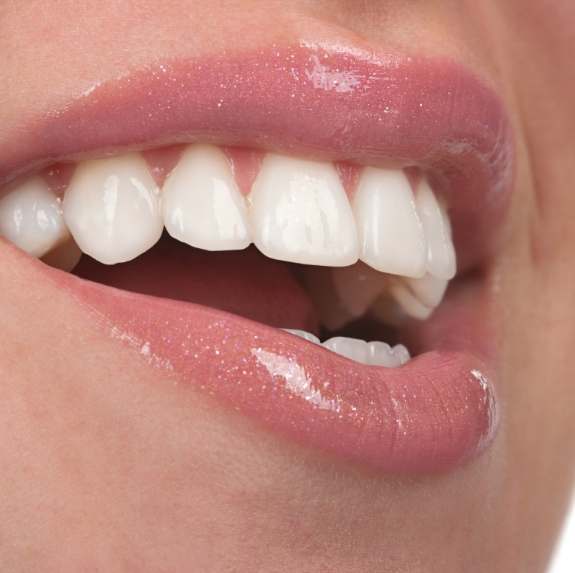 Close up of smile with straight white teeth