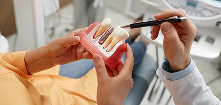 Dentist pointing to model of dental implant