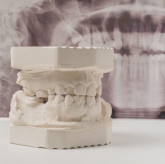 Example of dentures being made in Putnam