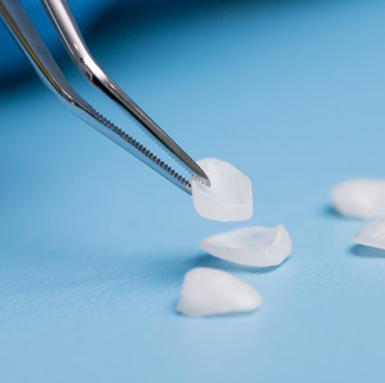 Tweezers carefully picking up a dental veneer